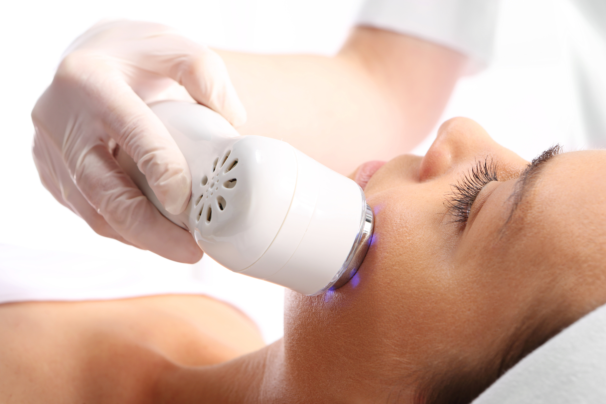 faq-about-intense-pulsed-light-therapy-del-campo-dermatology-laser